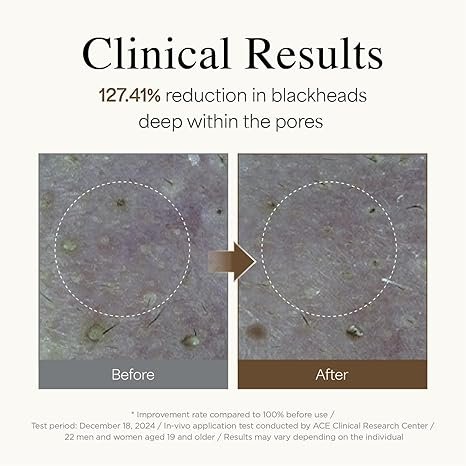 rice foaming cleanser